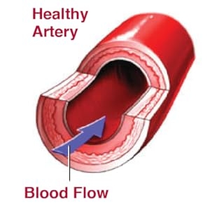 Artery